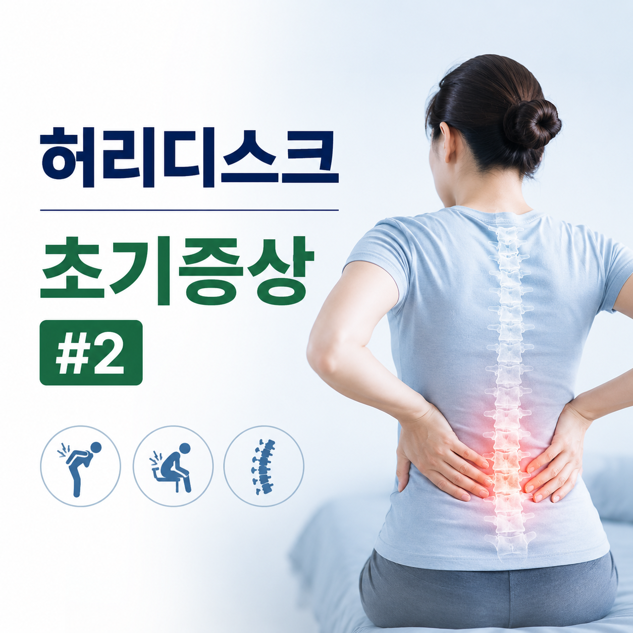 허리디스크 초기